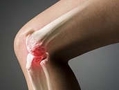 Физомед артро лечение коленного сустава